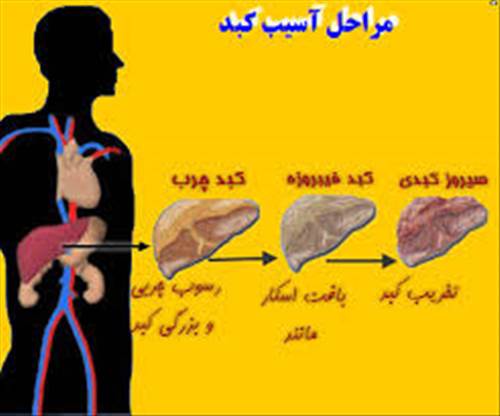 نشانه های نارسایی حاد کبد